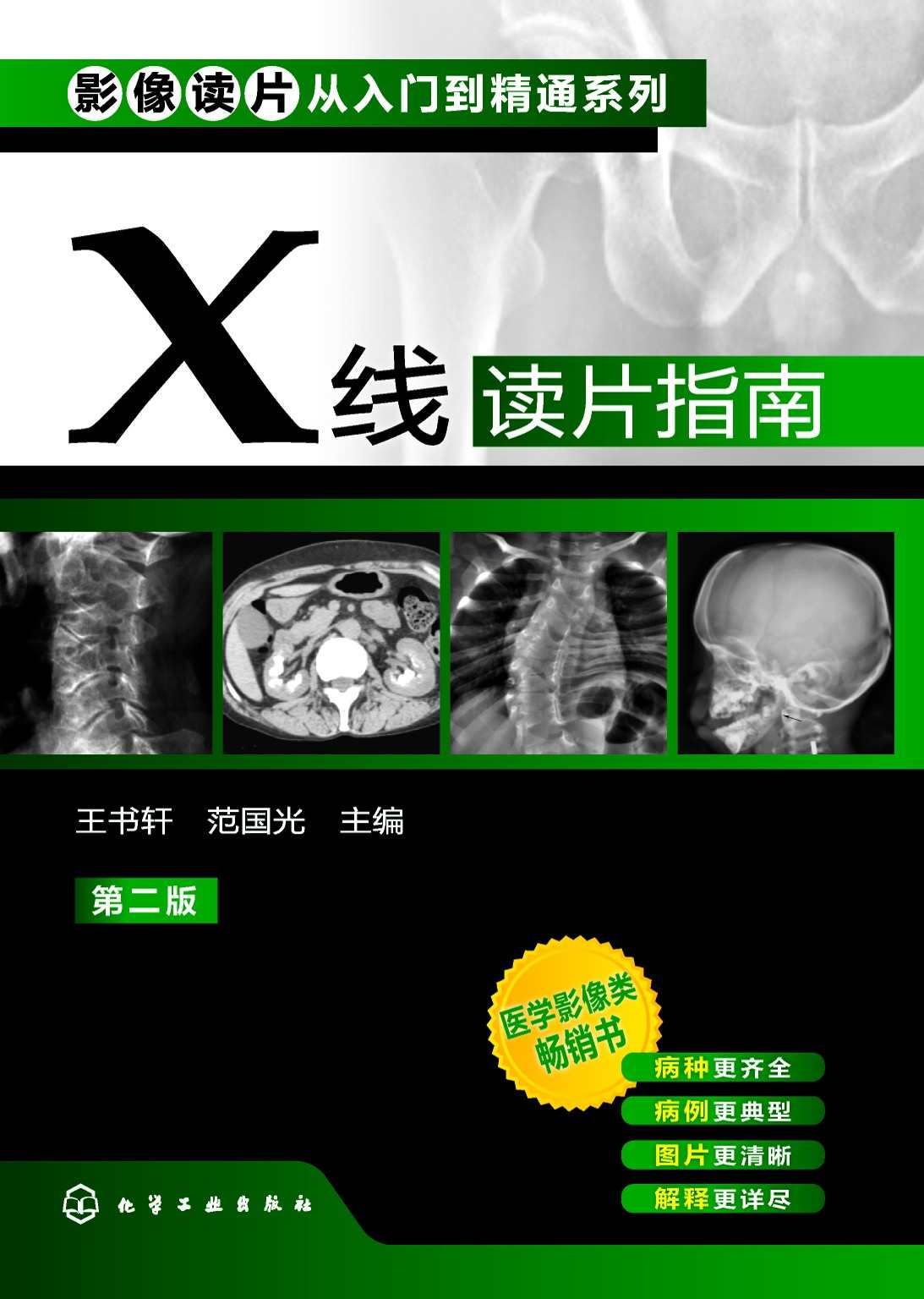 X线读片指南 (影像读片从入门到精通系列)